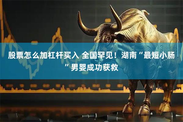 股票怎么加杠杆买入 全国罕见！湖南“最短小肠”男婴成功获救